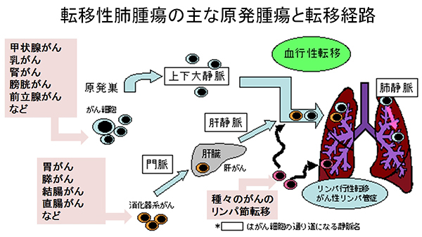 子宮がんの肺合併症にはどのようなものがありますか?